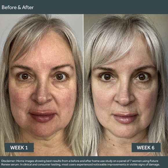 No 7 Future Renew Damage Reversal Serum - Picture 5 of 10